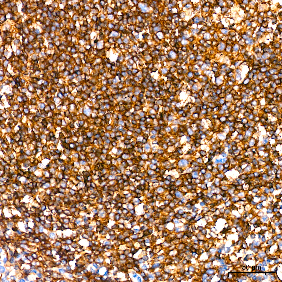 Leptin Receptor Rabbit mAb