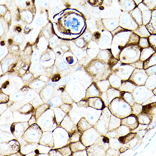 MUC1-C Rabbit mAb