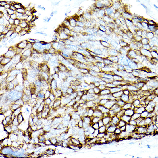 MUC1-C Rabbit mAb