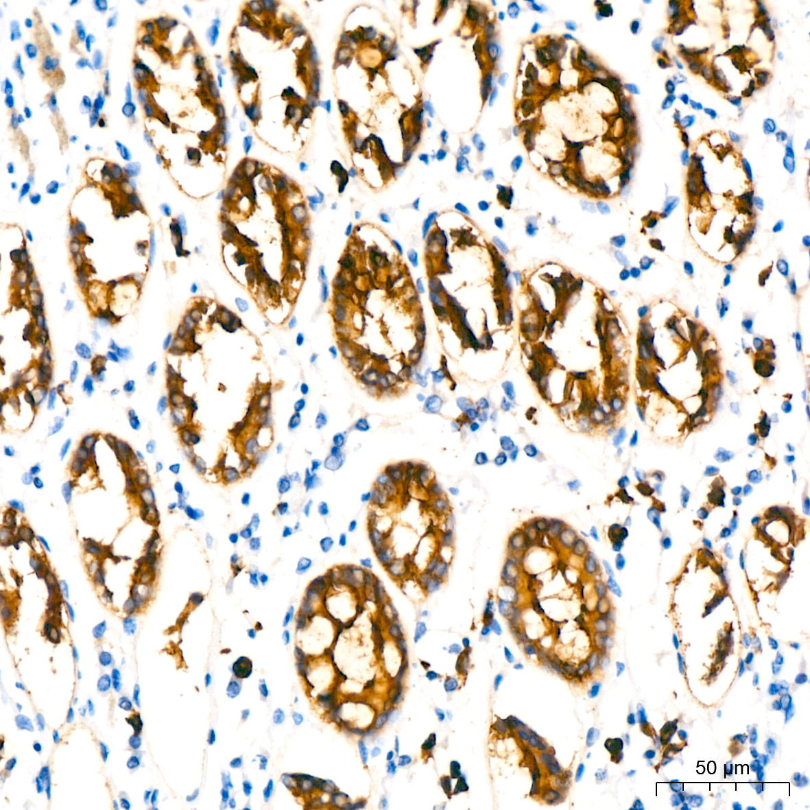 MUC1-C Rabbit mAb