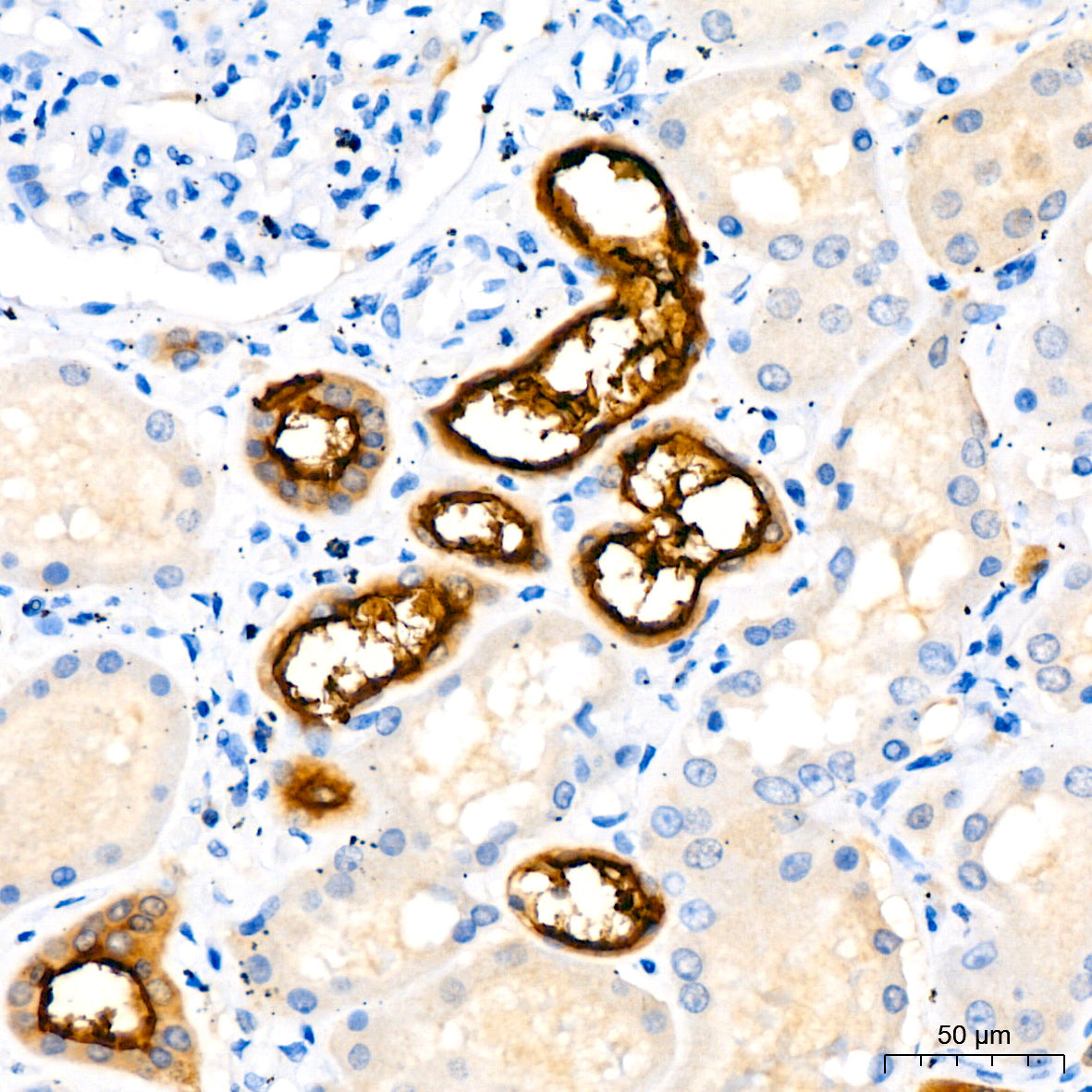 MUC1-C Rabbit mAb