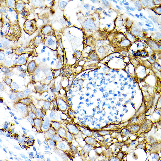 MUC1-C Rabbit mAb