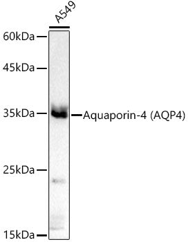 [KO Validated] MyD88 Rabbit mAb
