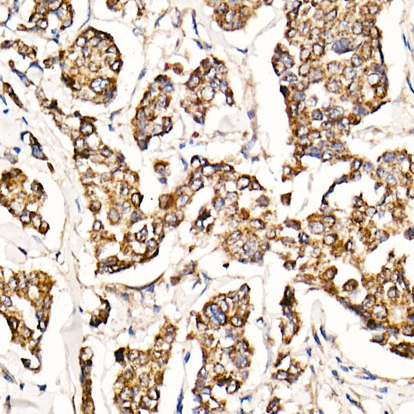 [KO Validated] MyD88 Rabbit mAb