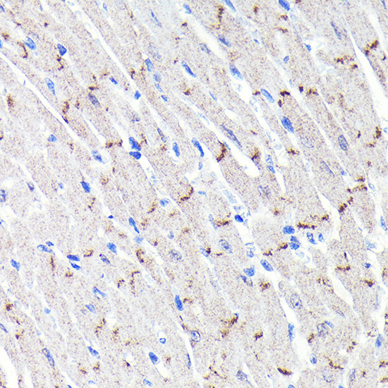 [KO Validated] N-Cadherin Rabbit mAb