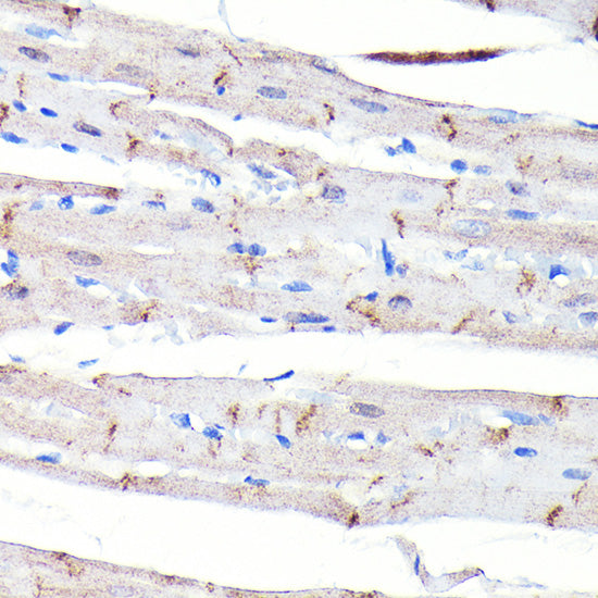 [KO Validated] N-Cadherin Rabbit mAb