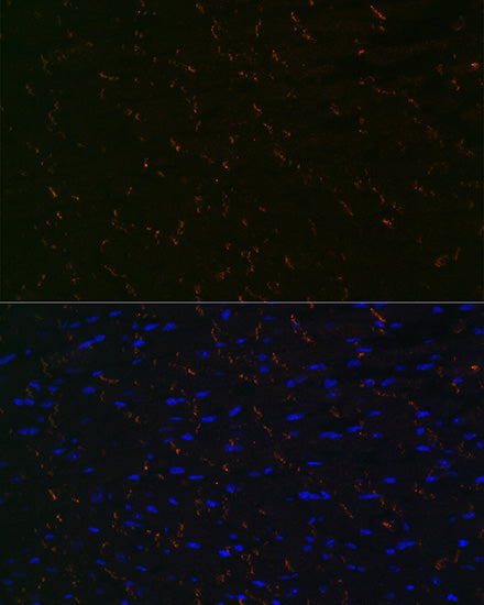 [KO Validated] N-Cadherin Rabbit mAb
