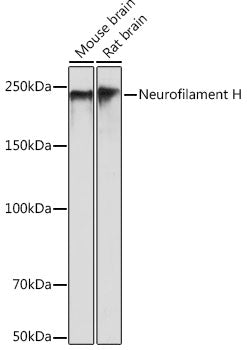 Neurofilament H Rabbit mAb