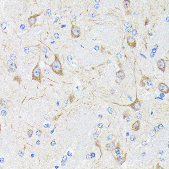 Neurofilament H Rabbit mAb