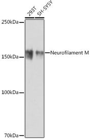 Neurofilament M Rabbit mAb
