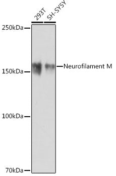 Neurofilament M Rabbit mAb