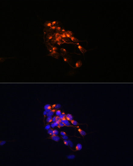 Neurofilament M Rabbit mAb