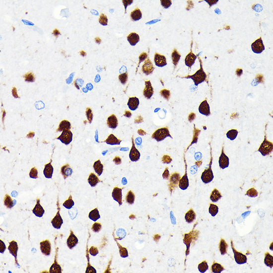 NeuN Rabbit mAb