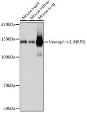 Neuropilin-1 (NRP1) Rabbit mAb