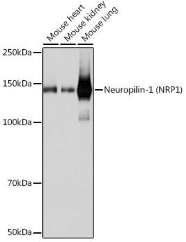 Neuropilin-1 (NRP1) Rabbit mAb