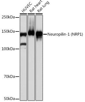 Neuropilin-1 (NRP1) Rabbit mAb