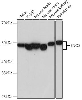 ENO2 Rabbit mAb