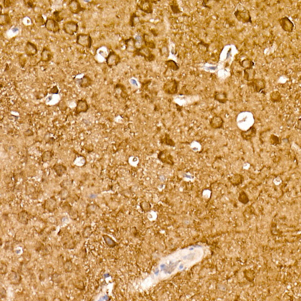 ENO2 Rabbit mAb