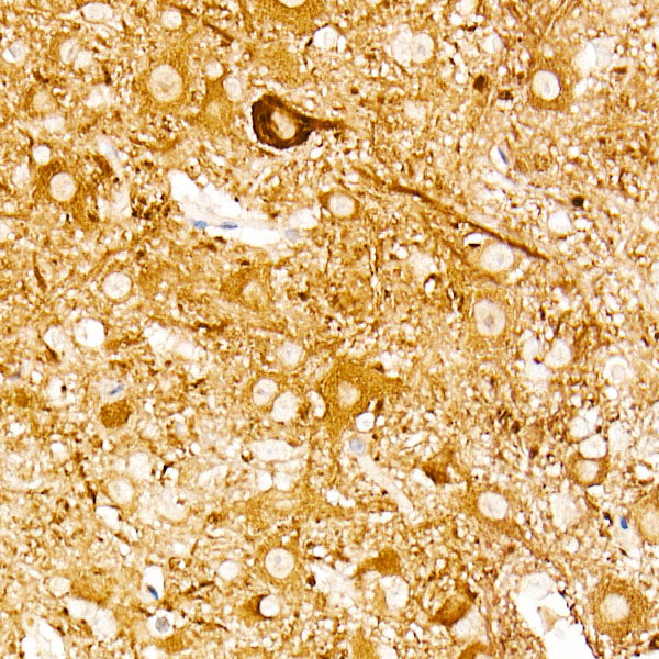 ENO2 Rabbit mAb