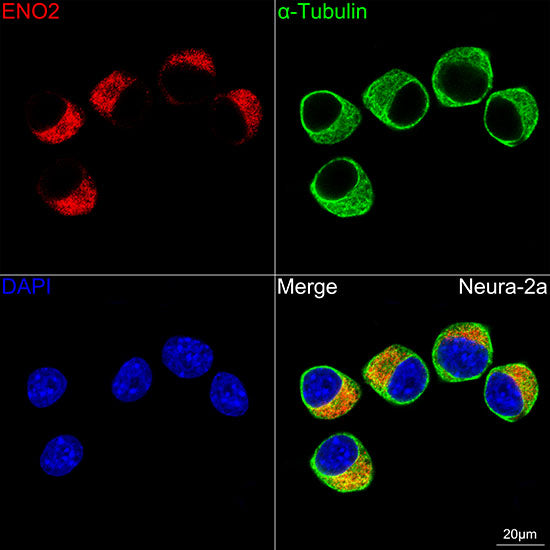 ENO2 Rabbit mAb