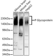 [KO Validated] P Glycoprotein Rabbit mAb