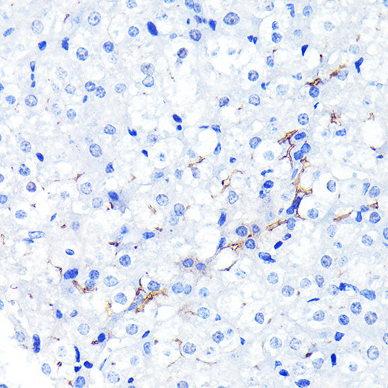 [KO Validated] P Glycoprotein Rabbit mAb