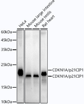 [KO Validated] CDKN1A/p21 Rabbit mAb