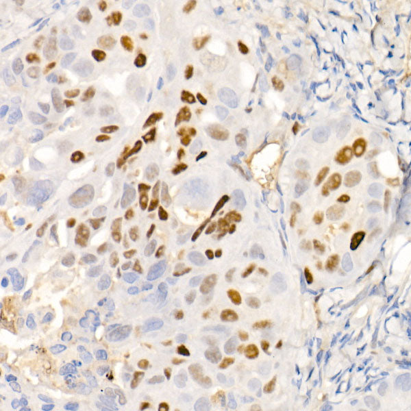 [KO Validated] CDKN1A/p21 Rabbit mAb