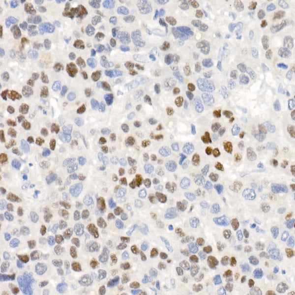 [KO Validated] CDKN1A/p21 Rabbit mAb
