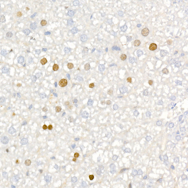 [KO Validated] CDKN1A/p21 Rabbit mAb