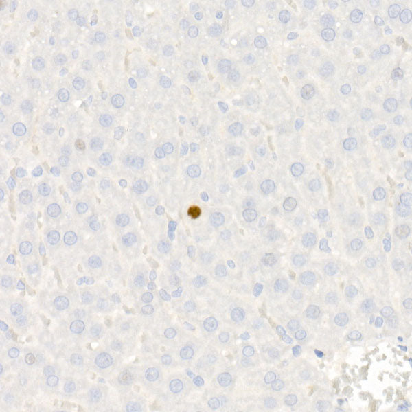 [KO Validated] CDKN1A/p21 Rabbit mAb
