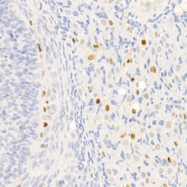 [KO Validated] CDKN1A/p21 Rabbit mAb