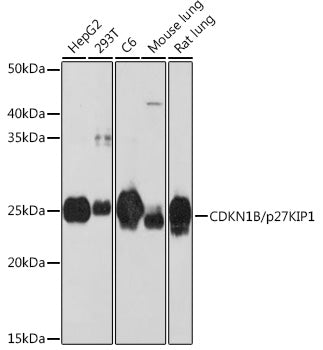 [KO Validated] CDKN1B/p27KIP1 Rabbit mAb
