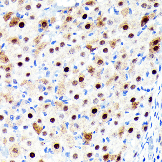 [KO Validated] CDKN1B/p27KIP1 Rabbit mAb