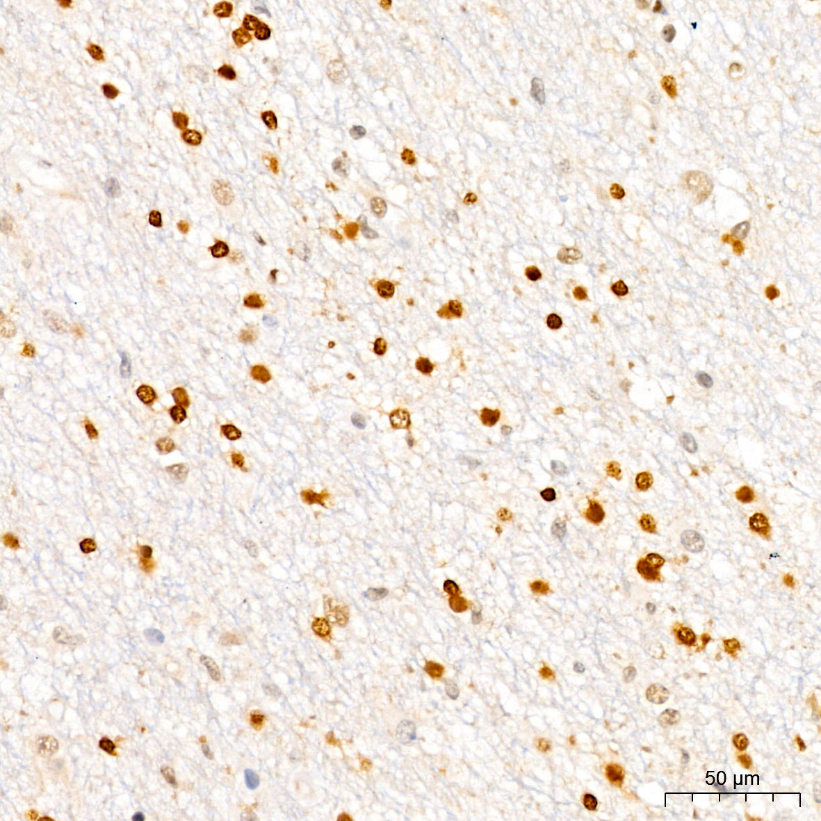 [KO Validated] CDKN1B/p27KIP1 Rabbit mAb