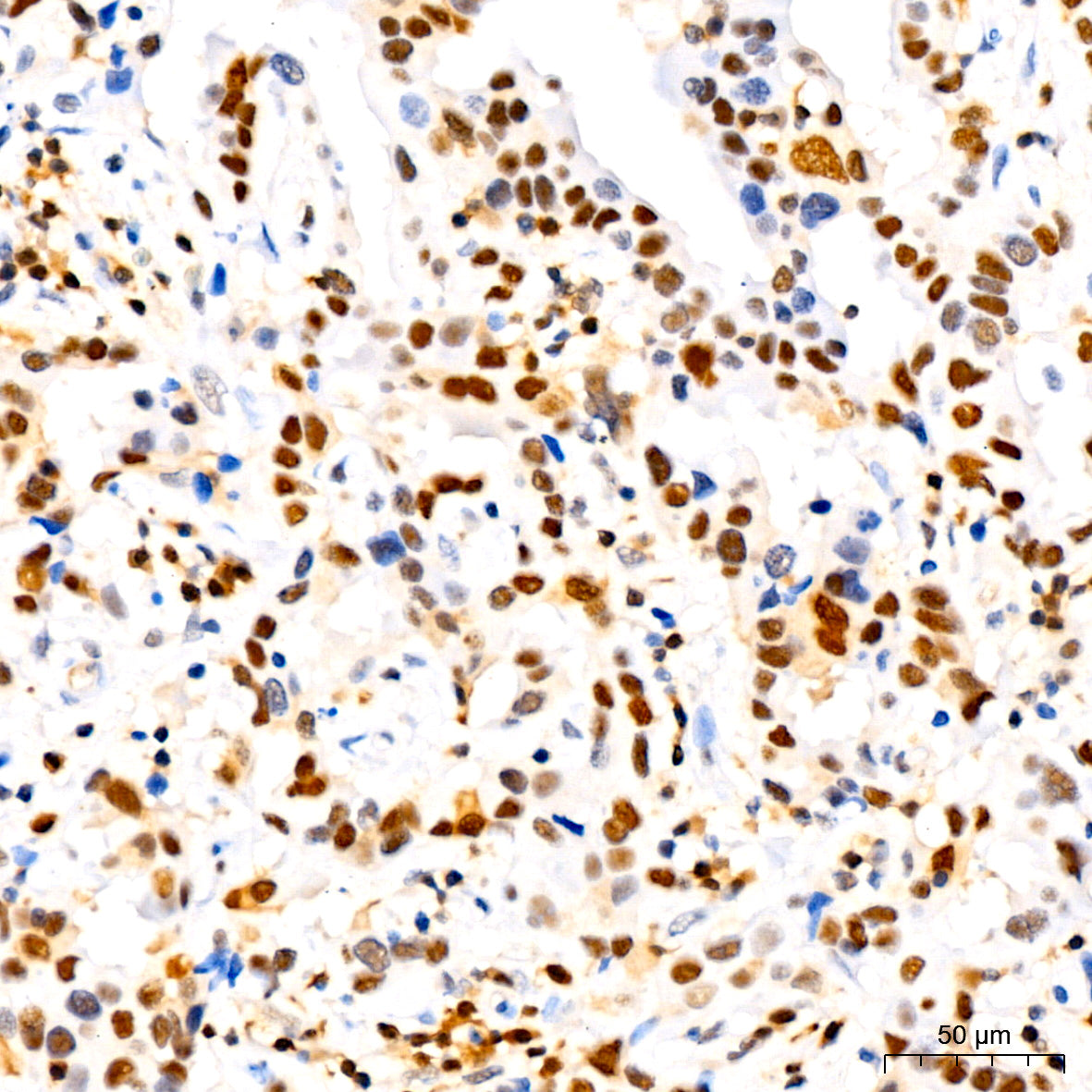 [KO Validated] CDKN1B/p27KIP1 Rabbit mAb