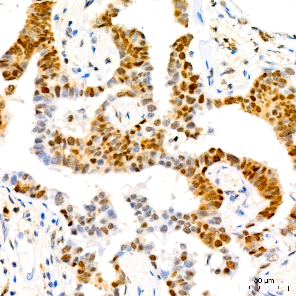 [KO Validated] CDKN1B/p27KIP1 Rabbit mAb
