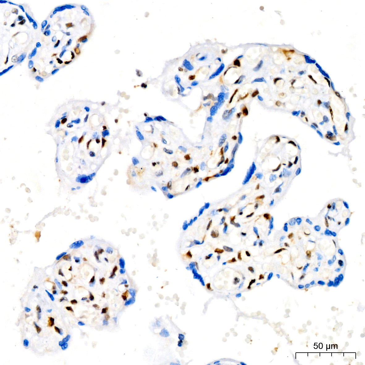 [KO Validated] CDKN1B/p27KIP1 Rabbit mAb