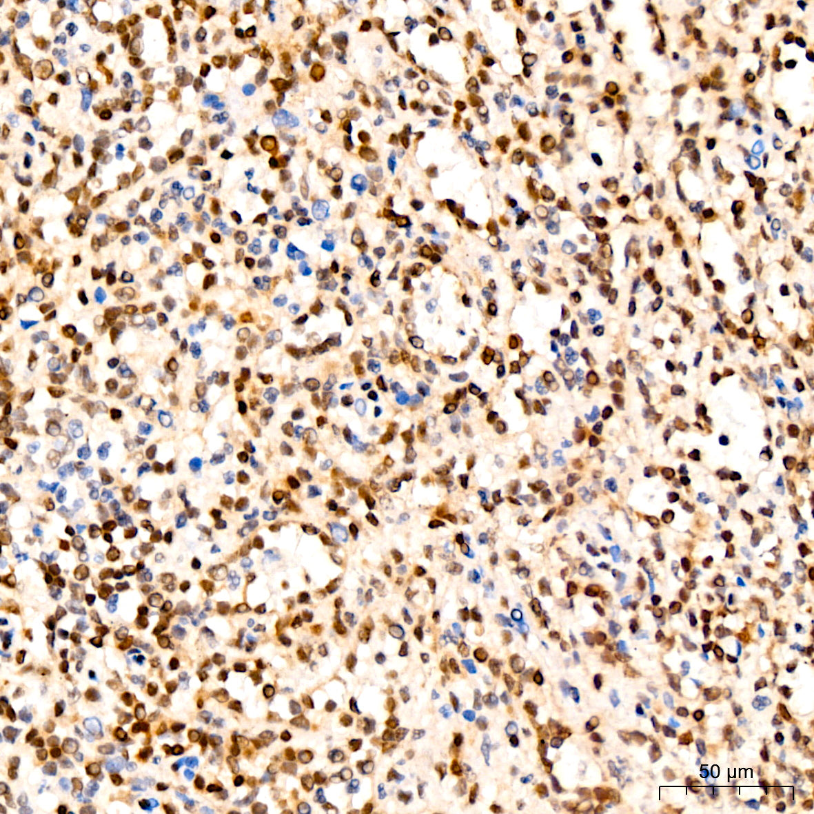 [KO Validated] CDKN1B/p27KIP1 Rabbit mAb