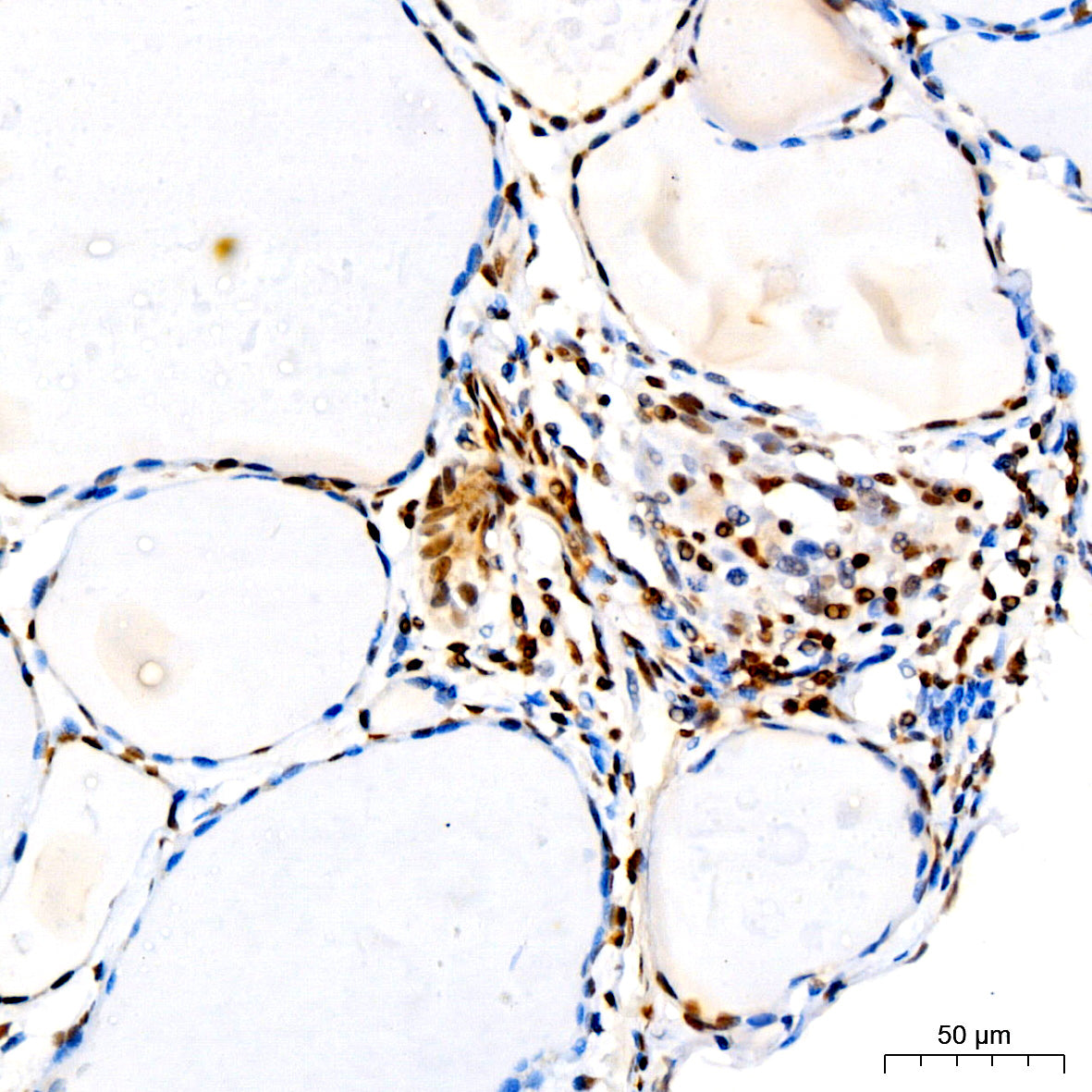 [KO Validated] CDKN1B/p27KIP1 Rabbit mAb