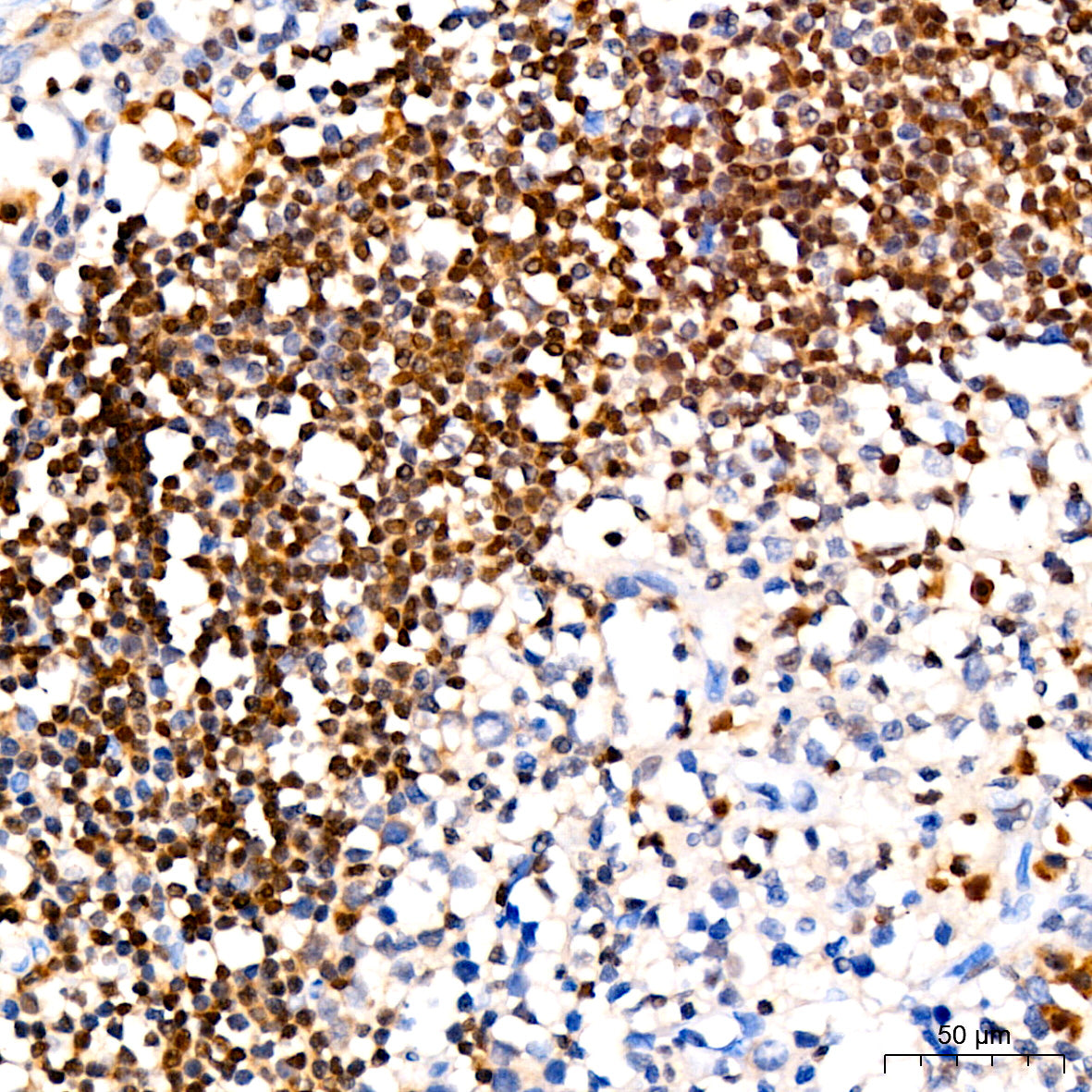 [KO Validated] CDKN1B/p27KIP1 Rabbit mAb