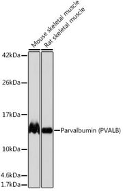 Parvalbumin/PVALB Rabbit mAb