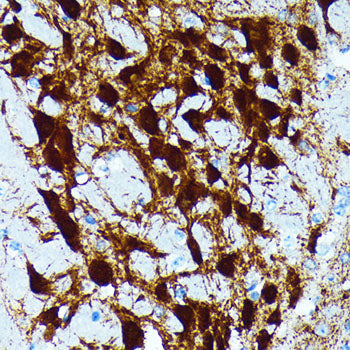 Parvalbumin/PVALB Rabbit mAb