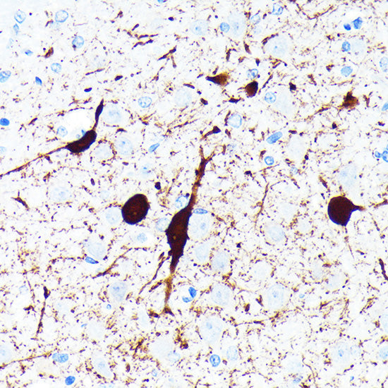 Parvalbumin/PVALB Rabbit mAb
