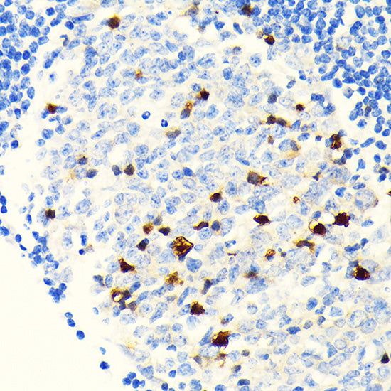Parvalbumin/PVALB Rabbit mAb