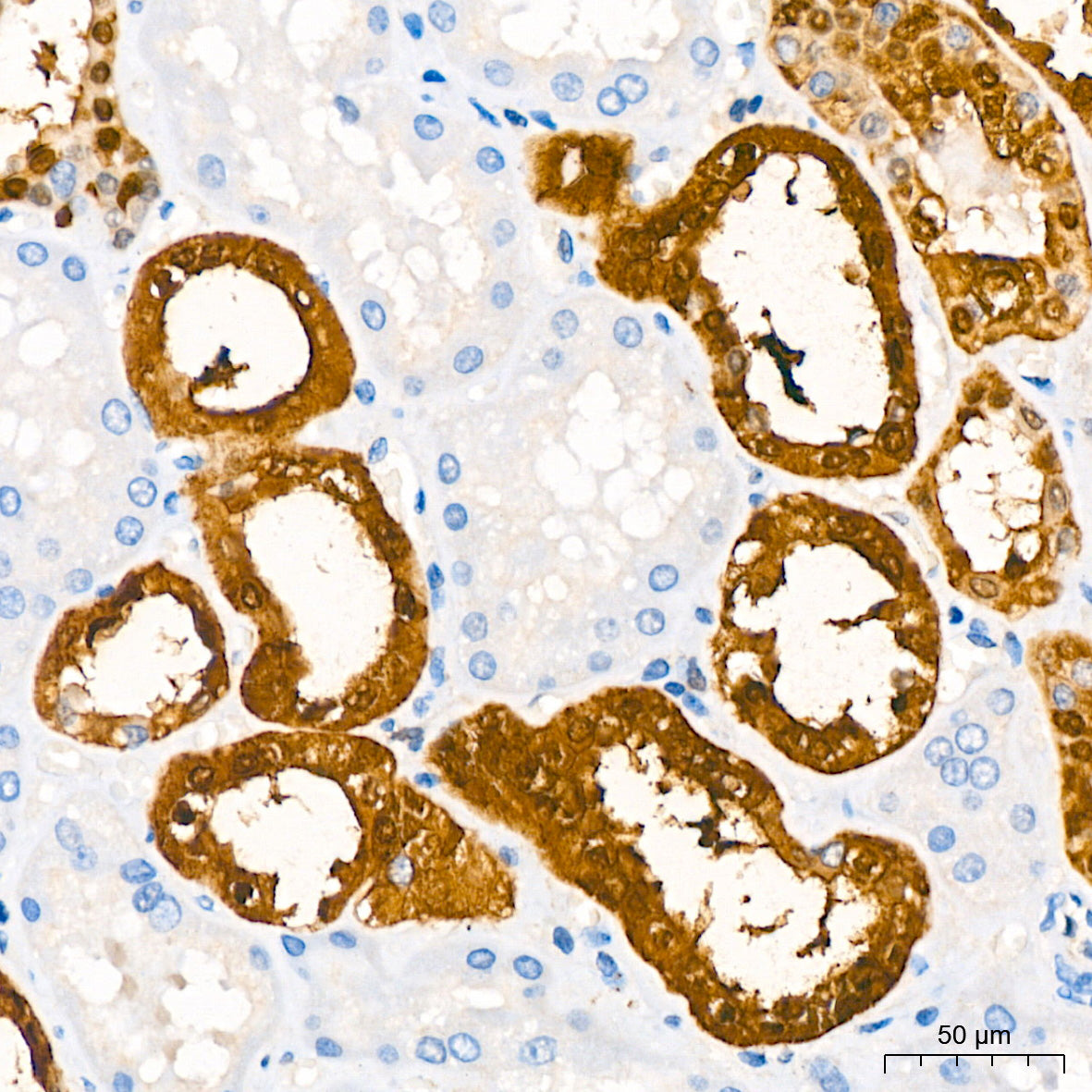 Parvalbumin/PVALB Rabbit mAb
