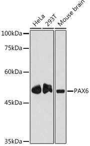 PAX6 Rabbit mAb
