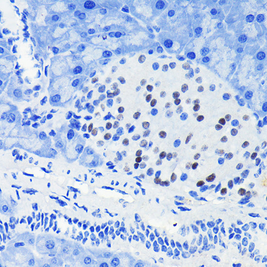 PAX6 Rabbit mAb