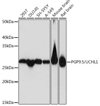 PGP9.5/UCHL1 Rabbit mAb