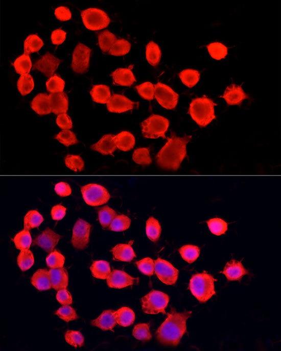 PGP9.5/UCHL1 Rabbit mAb